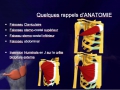 Traitement chirurgical des ruptures du Grand Pectoral chez le sportif