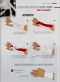 Tendinite du poignet (de Quervain) : Comment se faire un bandage taping ? 
